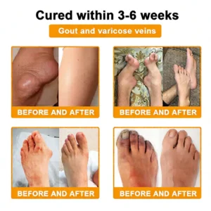 LOVILDS™  Bee Venom  Pain-Relief Bone Healing Cream 🎉🎉(Specially for older adults)