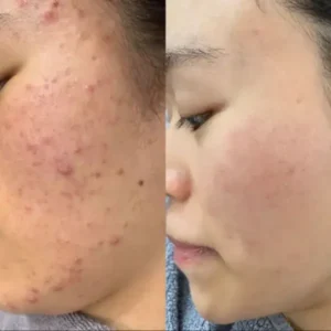 LOVILDS™ Facial Cream with 7% Arbutin + 4% Tranexamic Acid