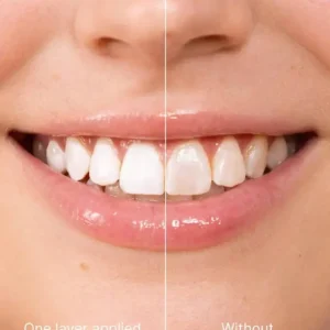 LOVILDS™ Tooth Polish - Instant Whitening for a Sparkling Smile