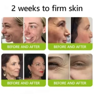 ODALIT™ Botox Retinol Shot , FDA-Compliant Formula to Firm Sagging Skin Reduce Puffy Eyes