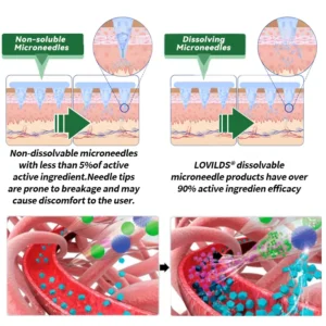 𝑶𝒇𝒇𝒊𝒄𝒊𝒂𝒍 𝑺𝒕𝒐𝒓𝒆 |🛡️LOVILDS® 𝑴𝒐𝒓𝒊𝒏𝒈𝒂 & 𝑩𝒆𝒓𝒃𝒆𝒓𝒊𝒏𝒆 10-𝑰𝑵-1 𝑨𝒅𝒗𝒂𝒏𝒄𝒆𝒅 𝑵𝒂𝒏𝒐 𝑴𝒊𝒄𝒓𝒐𝒏𝒆𝒆𝒅𝒍𝒆 𝑷𝒂𝒕𝒄𝒉 (𝐎𝐧𝐜𝐞 𝐃𝐚𝐢𝐥𝐲, 𝐯𝐢𝐬𝐢𝐛𝐥𝐞 𝐜𝐡𝐚𝐧𝐠𝐞𝐬 𝐢𝐧 𝟕 𝐝𝐚𝐲𝐬）✅ 𝐎𝐛𝐞𝐬𝐢𝐭𝐲, 𝐃𝐢𝐚𝐛𝐞𝐭𝐞𝐬, 𝐒𝐥𝐞𝐞𝐩 𝐀𝐩𝐧𝐞𝐚, 𝐀𝐧𝐝 𝐉𝐨𝐢𝐧𝐭 𝐈𝐬𝐬𝐮𝐞𝐬