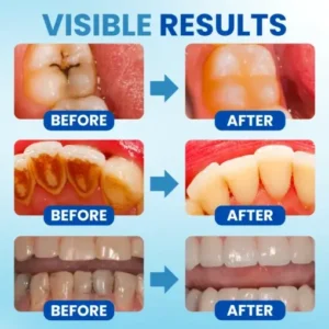 AEXZR® Anti-Plaque Oral Serum