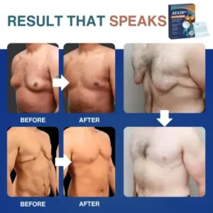 AEXZR® Nano-Microneedle Chest-Sculpt Bio-Patch (𝐉𝐮𝐬𝐭 𝐨𝐧𝐜𝐞 𝐚 𝐝𝐚𝐲, 𝐯𝐢𝐬𝐢𝐛𝐥𝐞 𝐜𝐡𝐚𝐧𝐠𝐞𝐬 𝐢𝐧 𝟕 𝑫𝐚𝐲𝐬 𝐅𝐨𝐫 𝐆𝐲𝐧𝐞𝐜𝐨𝐦𝐚𝐬𝐭𝐢𝐚, 𝐄𝐱𝐜𝐞𝐬𝐬 𝐂𝐡𝐞𝐬𝐭 𝐅𝐚𝐭, 𝐒𝐚𝐠𝐠𝐢𝐧𝐠 𝐒𝐤𝐢𝐧, 𝙇𝙊𝙊𝙎𝗘 𝗦𝗞𝗜𝗡, 𝐚𝐧𝐝 𝐦𝐨𝐫𝐞