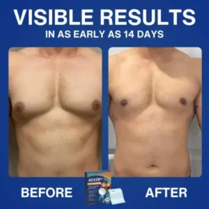 AEXZR® Nano-Microneedle Chest-Sculpt Bio-Patch (𝐉𝐮𝐬𝐭 𝐨𝐧𝐜𝐞 𝐚 𝐝𝐚𝐲, 𝐯𝐢𝐬𝐢𝐛𝐥𝐞 𝐜𝐡𝐚𝐧𝐠𝐞𝐬 𝐢𝐧 𝟕 𝑫𝐚𝐲𝐬 𝐅𝐨𝐫 𝐆𝐲𝐧𝐞𝐜𝐨𝐦𝐚𝐬𝐭𝐢𝐚, 𝐄𝐱𝐜𝐞𝐬𝐬 𝐂𝐡𝐞𝐬𝐭 𝐅𝐚𝐭, 𝐒𝐚𝐠𝐠𝐢𝐧𝐠 𝐒𝐤𝐢𝐧, 𝙇𝙊𝙊𝙎𝗘 𝗦𝗞𝗜𝗡, 𝐚𝐧𝐝 𝐦𝐨𝐫𝐞