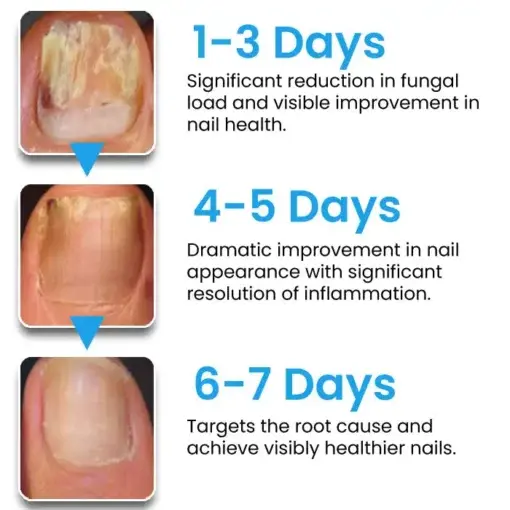 AEXZR® NanoFix Repair Pen