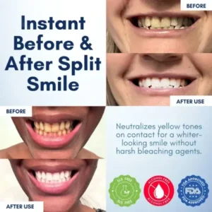 AEXZR® Pro-Bright Teeth Gloss – Instant Radiant Smile