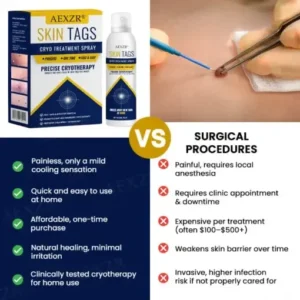 AEXZR® Skin Tag Cryo Treatment Spray Precision Cryo-Tech Freezes Away Skin Tags Warts in Seconds No Blades, No Pain.