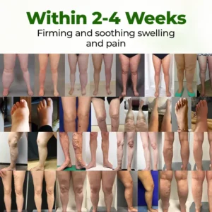 Clinclii® Professional Leg Circulation Cream