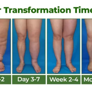 Clinclii® Professional Leg Circulation Cream