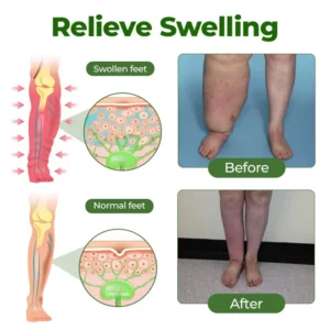 Clinclii® Professional Leg Circulation Cream