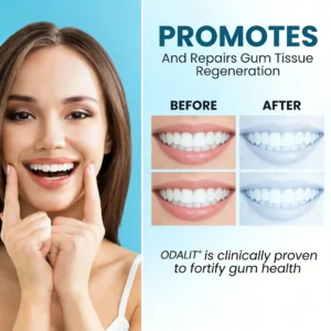 🔥Final 3 Hours: 80% OFF - 🐝ODALIT® Smilewell Bee Venom Oral Care Powder🦷