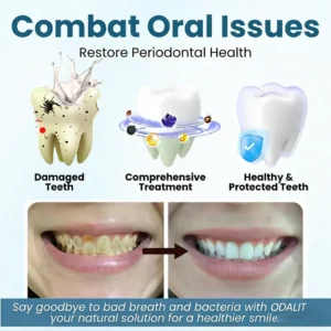 🔥Final 3 Hours: 80% OFF - 🐝ODALIT® Smilewell Bee Venom Oral Care Powder🦷