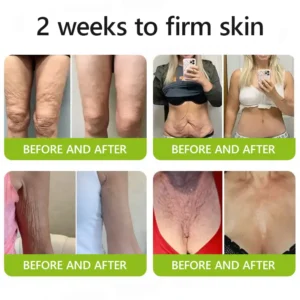 [🥇Last Day 70% OFF] ODALIT™ Botox & Retinol Shot - Eraser for Deep Wrinkles, Sagging Jowls & Puffy Eyes