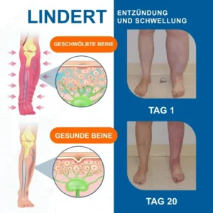 🏆Offizieller Store | 🛡️ Holen Sie sich das Gefühl von Leichtigkeit in 7 Tagen zurück! AEXZR® LYMPHÖDEM-Drainage-Massagecreme